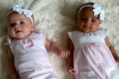 В Великобритании родились разноцветные близнецы