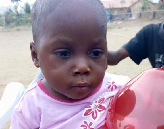 Читать Спасение нигерийского малыша Хоупа: Два месяца спустя