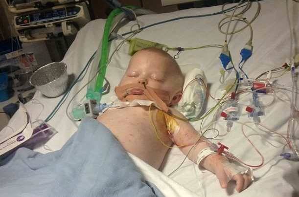 Читать Младенец попал в больницу с ветрянкой, но чуть не погиб от плотоядной бактерии