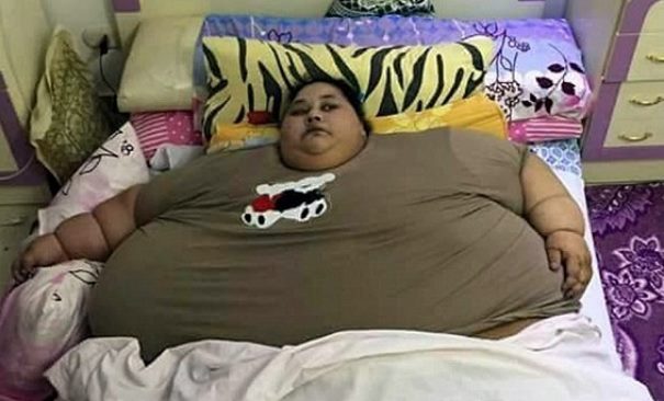 Египтянка весит 500 кг и может умереть без операции