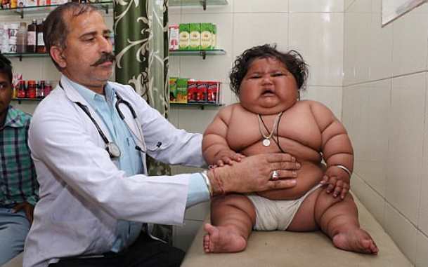 8-месячная индийская девочка весит как 4-х летний ребенок