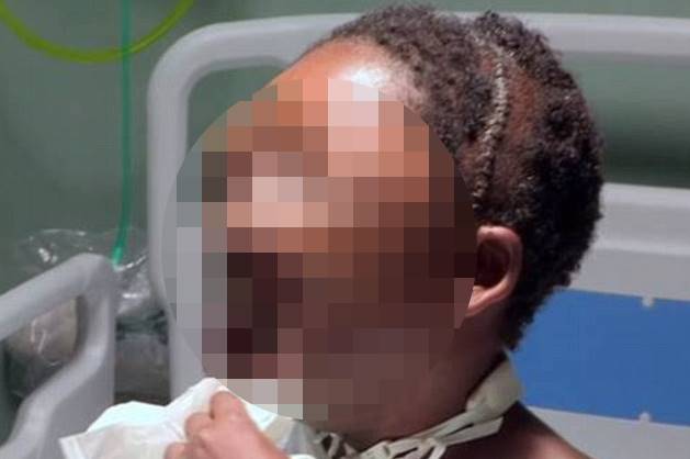 Огромная опухоль на лице убила подростка из Уганды (Осторожно! Шокирующий контент)