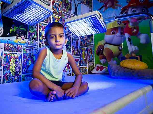 4-летний мальчик проводит почти все время под синими лампами иначе он умрет