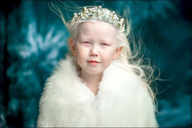 Девочка-альбинос из Якутии