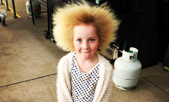 Девочка с необычными волосами из-за редкой генетической аномалии