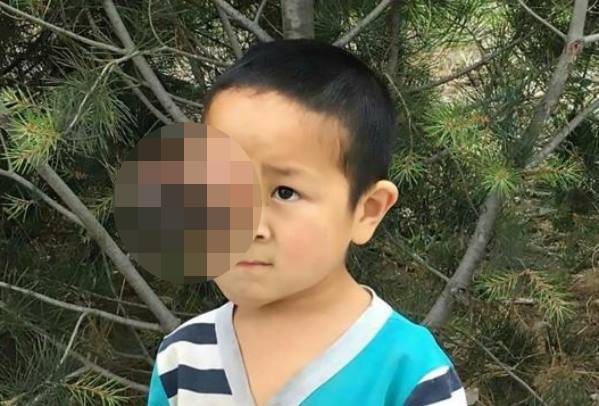 6-летнему мальчику удалили огромную опухоль глазницы